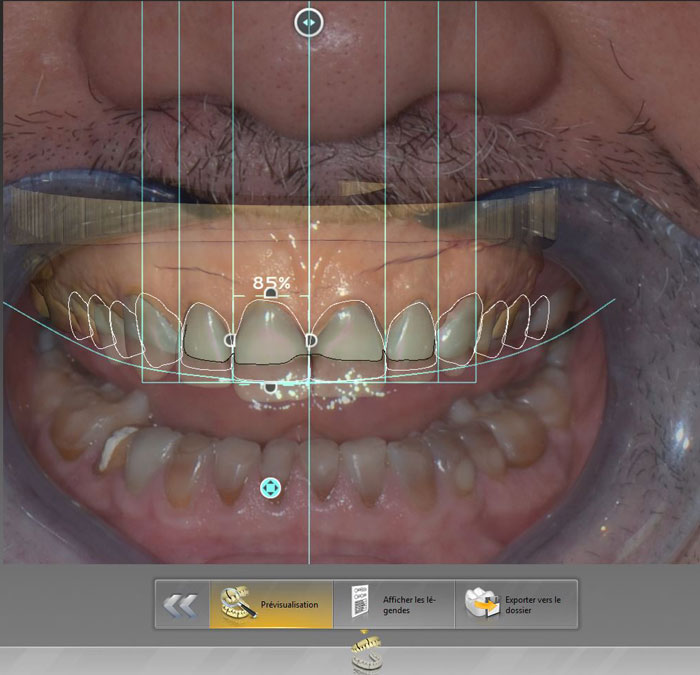 Smile Designer Pro